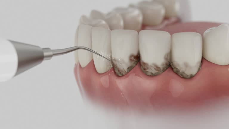 Reliable Dental Crowns And Bridges contractor in Vernon Parish County, LA by Dentist Open Now